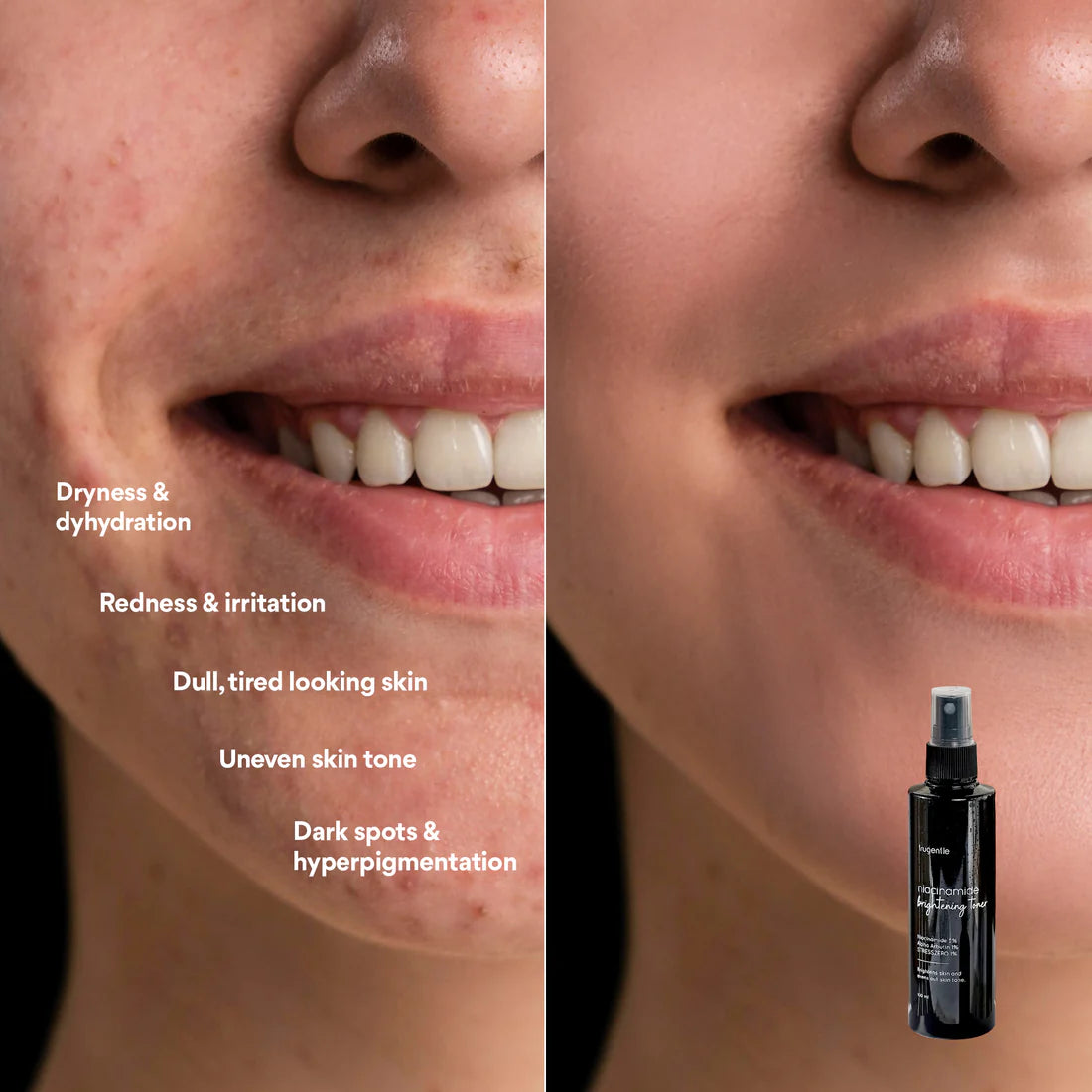 Niacinamide Brightening Toner