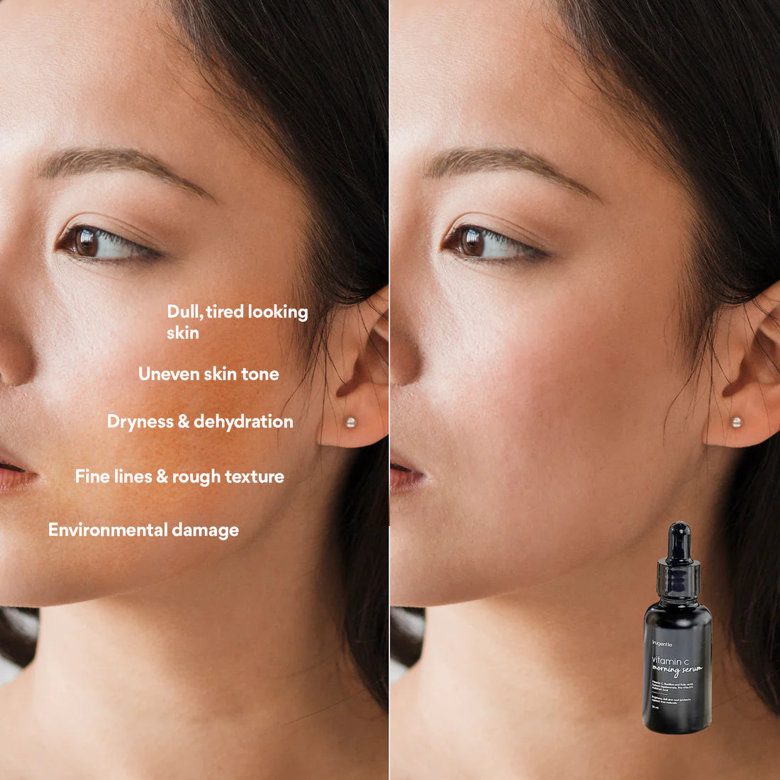 Breakout Control Kit